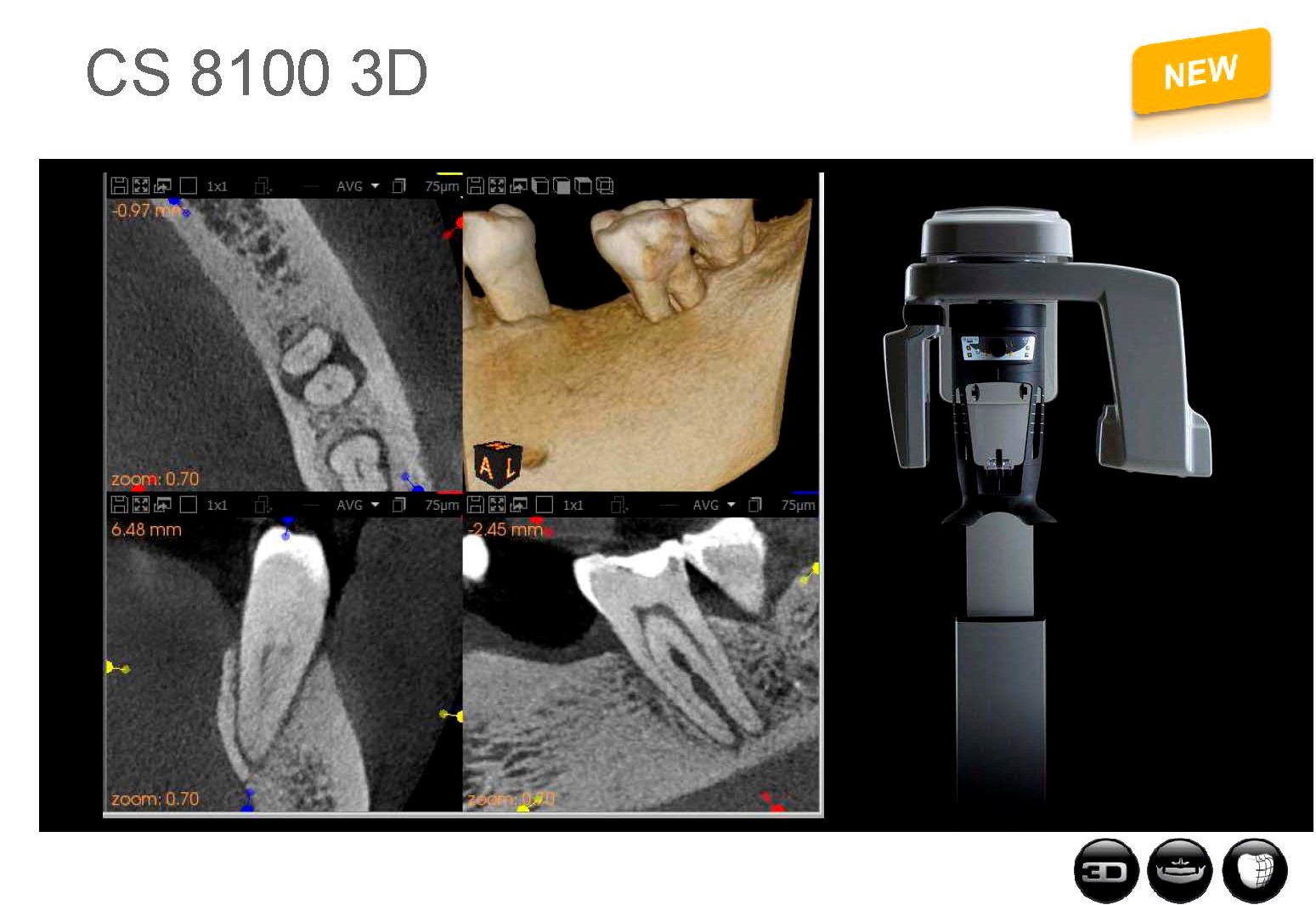 Carestream Imaging Raleigh NC, North Carolina Endodontics